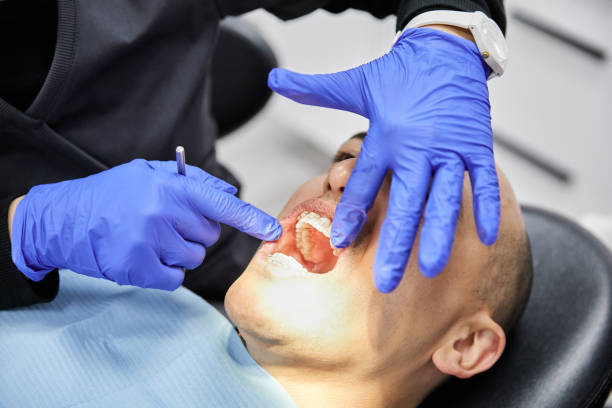 Best Emergency Gum Treatment in Dover, NJ